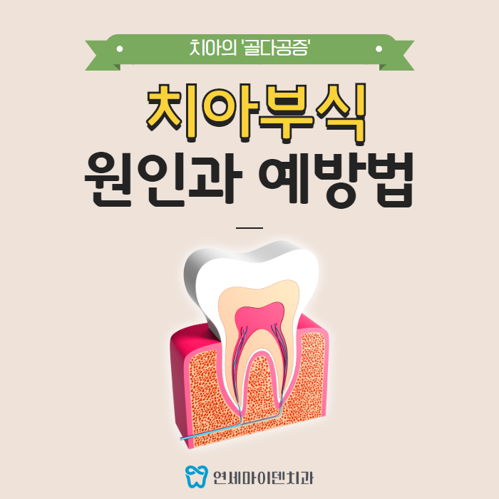 치아부식 예방법 (1).png