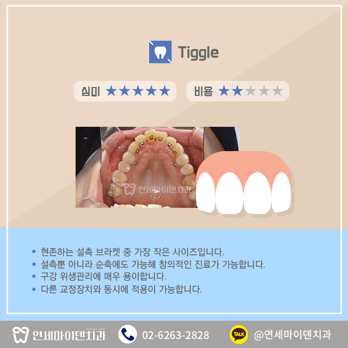 교정치료(종류) (6).jpg