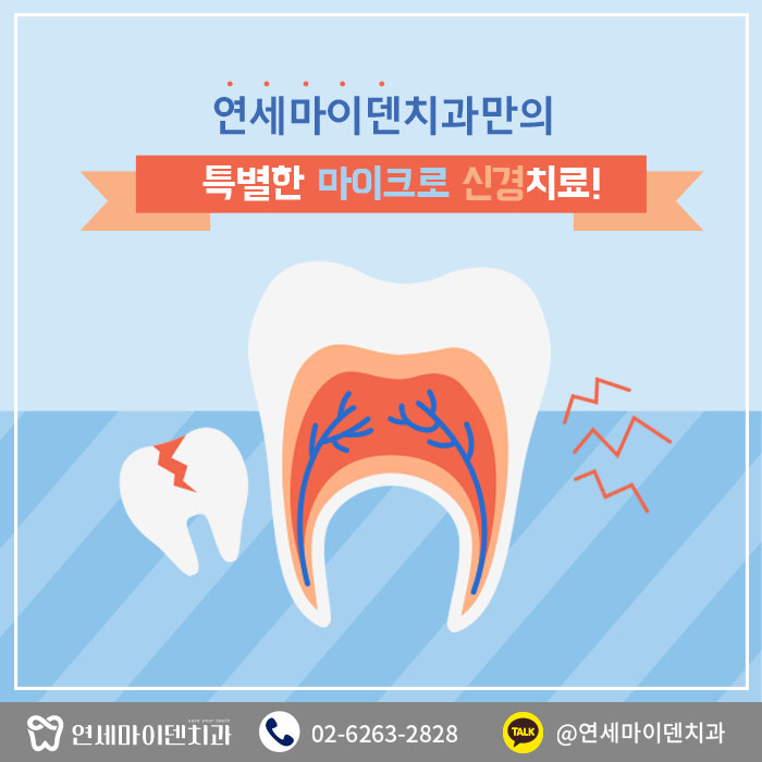 마이크로신경치료 (1).jpg