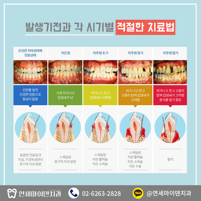 자신있는잇몸치료 (3).jpg