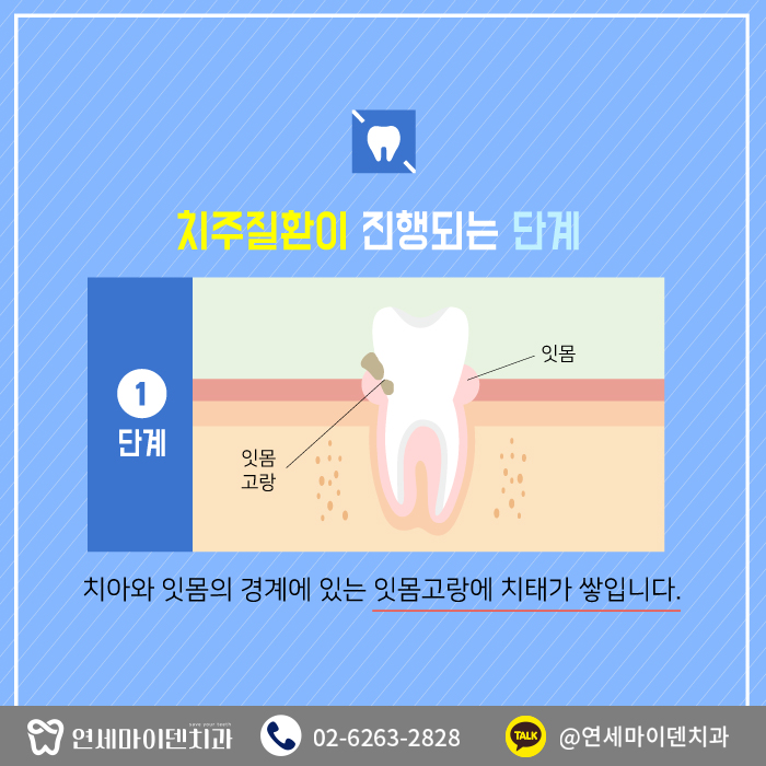 치과를찾는이유-치주질환 (4).jpg