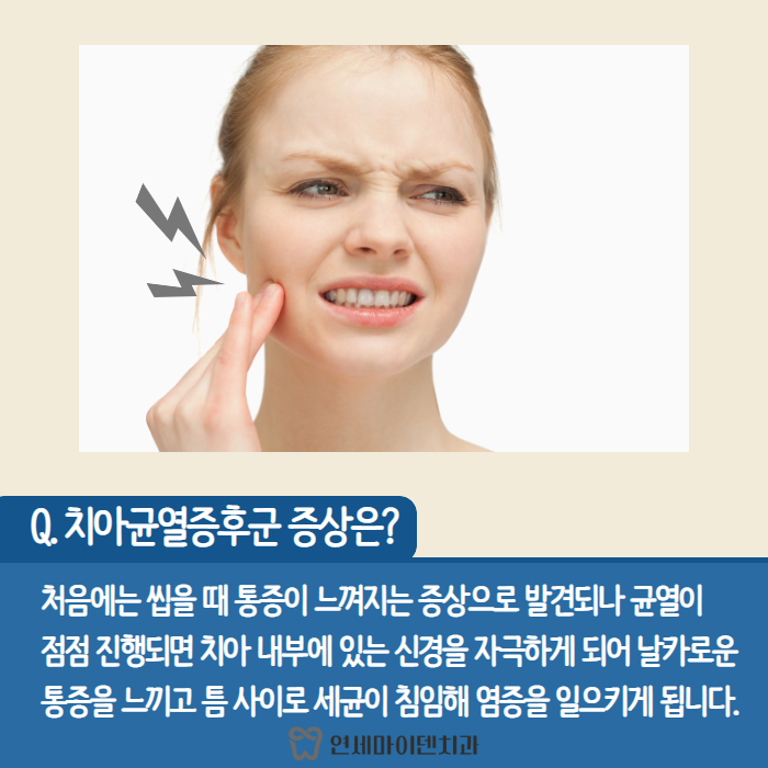 치아균열증후군 (3).png