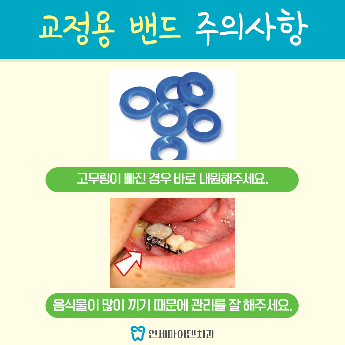 교정용 밴드 (5).png