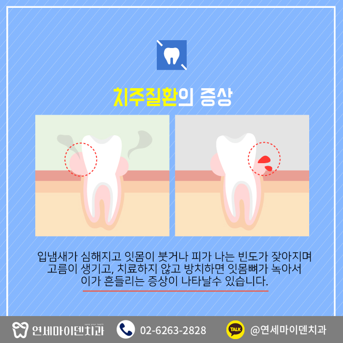 치과를찾는이유-치주질환 (3).jpg