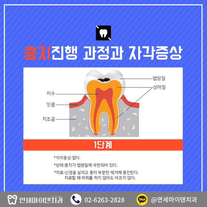 치과를찾는이유-충치편 (3).jpg