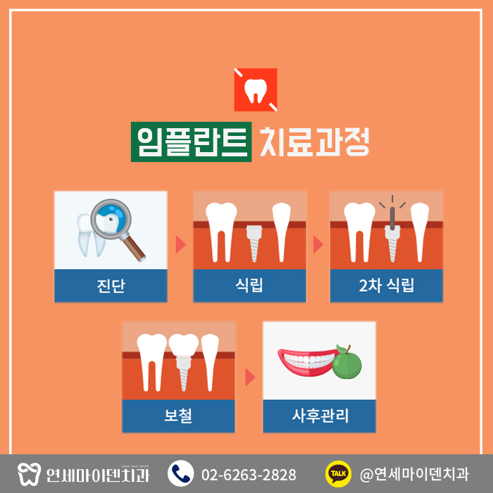 임플란트시작부터제대로하자 (4).jpg