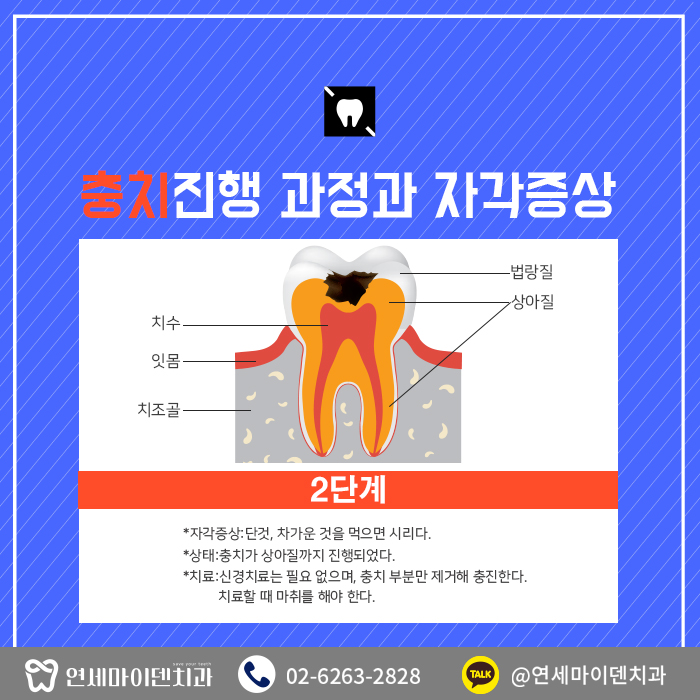 치과를찾는이유-충치편 (4).jpg