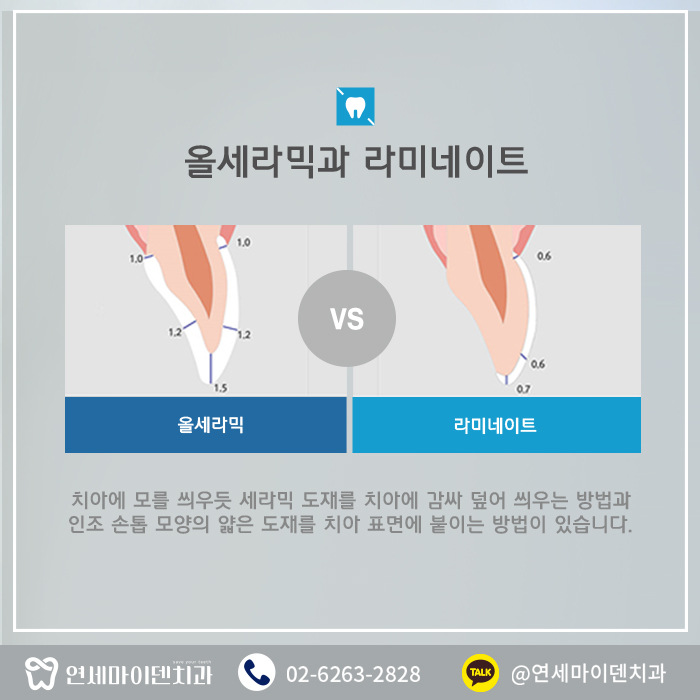 올세라믹 (5).jpg