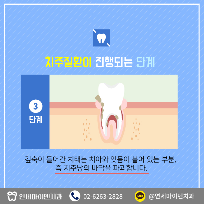 치과를찾는이유-치주질환 (6).jpg