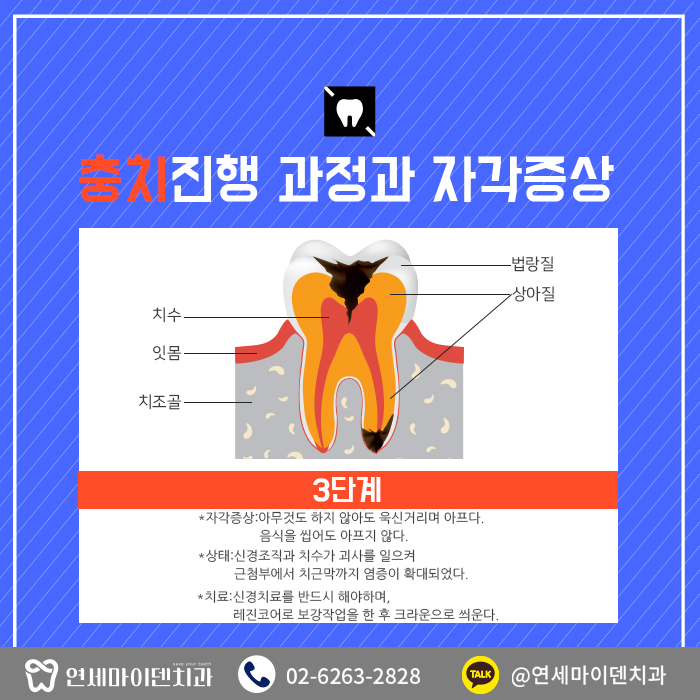 치과를찾는이유-충치편 (5).jpg