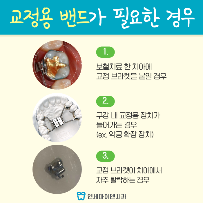 교정용 밴드 (3).png