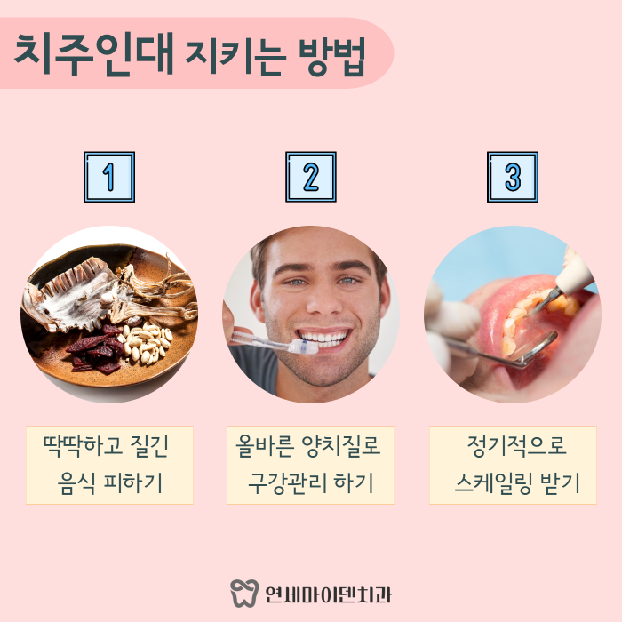 치아를 감싸주는 치주인대가 중요한 이유 (5).png