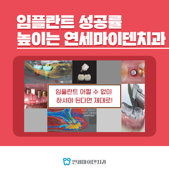 임플란트 ISQ 측정 (5).png