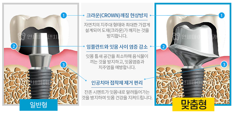 맞춤 지대주 2.jpg