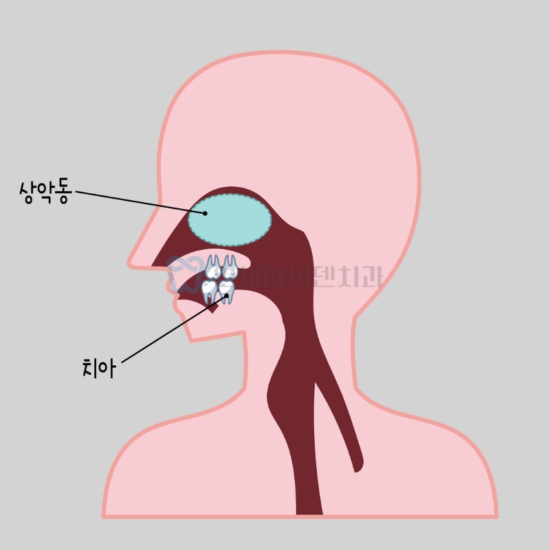 제목을 입력하세요 6.jpg