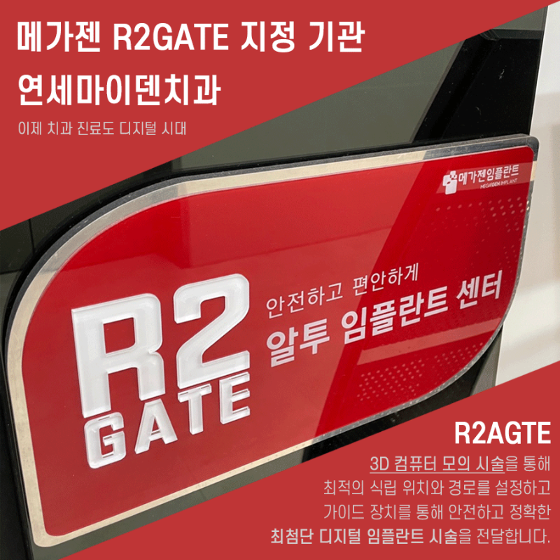 R2Gate-임플란트.gif