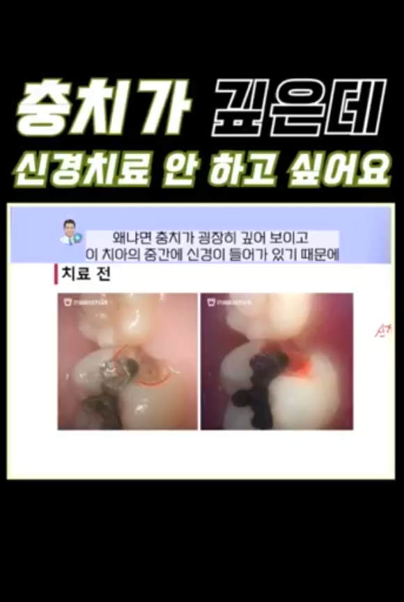 썸네일_닥터꼬집 4월 8일.png