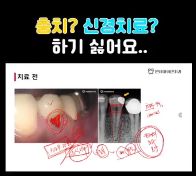 shorts_케이스 4월 18일 썸네일.png