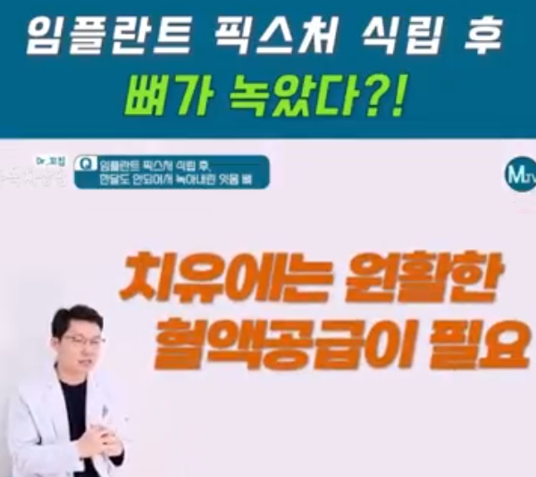 썸네일_마이덴티비 4월 21일.png