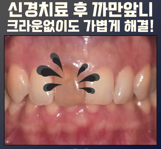 화면 캡처 2024-06-03 104311.png