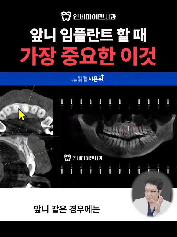 240905_비온뒤롱폼3_admin.jpg