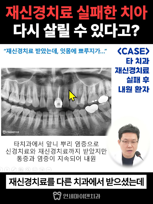 질문3_재신경케이스_admin.jpg