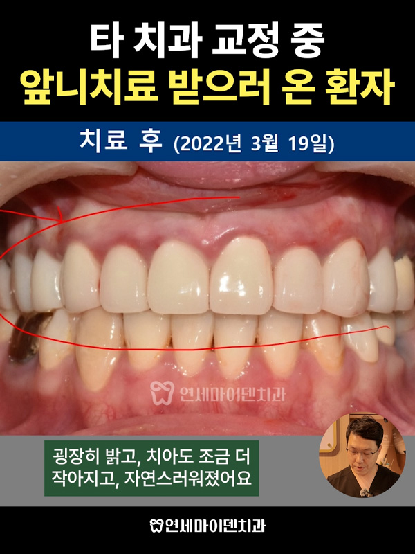 케이스256_admin_3.jpg