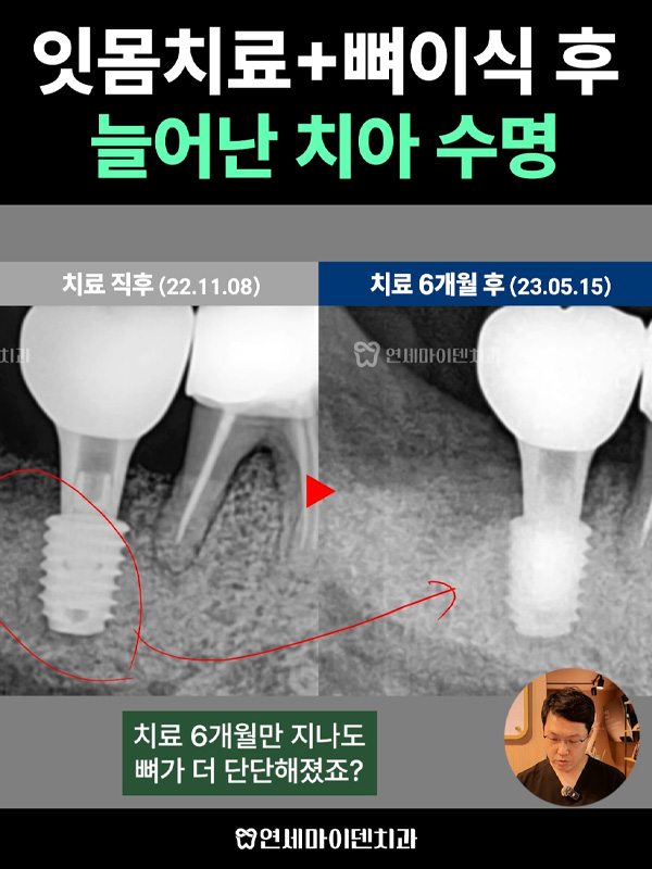 케이스260_admin_1.jpg
