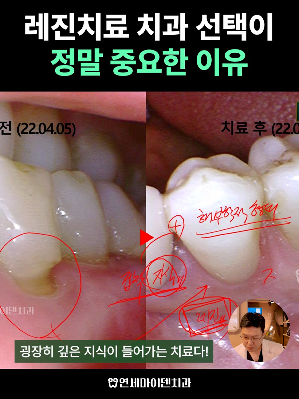 케이스262_admin_1.jpg