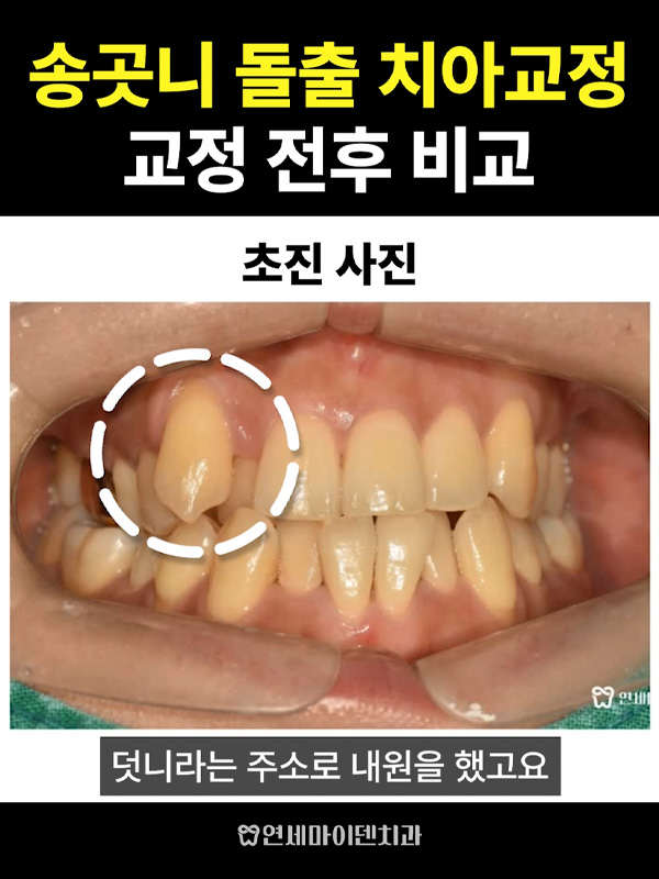 교정케이스10_admin_2.jpg