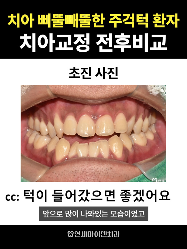 교정케이스08_admin_2.jpg