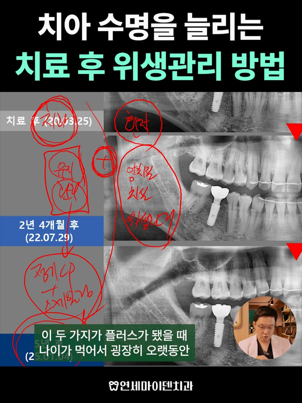 케이스276_admin_1.jpg